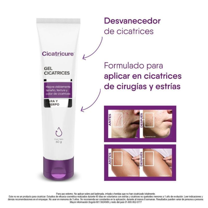 cicatricure-gel-60-gr---cicatricure-gel-30-gr-genomma
