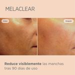 Serum Facial Isdin Melaclear Frasco 15ml