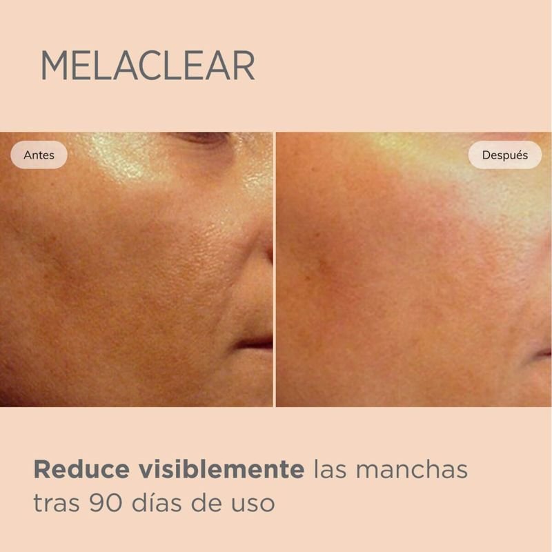 Serum Facial Isdin Melaclear Frasco 15ml